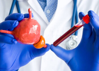 The Importance of a BPH Supplement